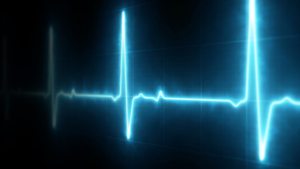 an EKG heart monitor